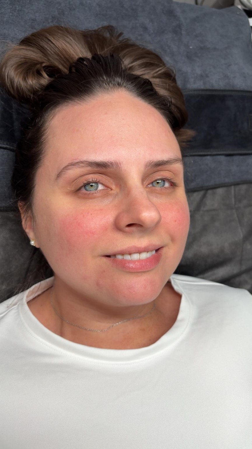 Before facial treatment - Calming and Glow
