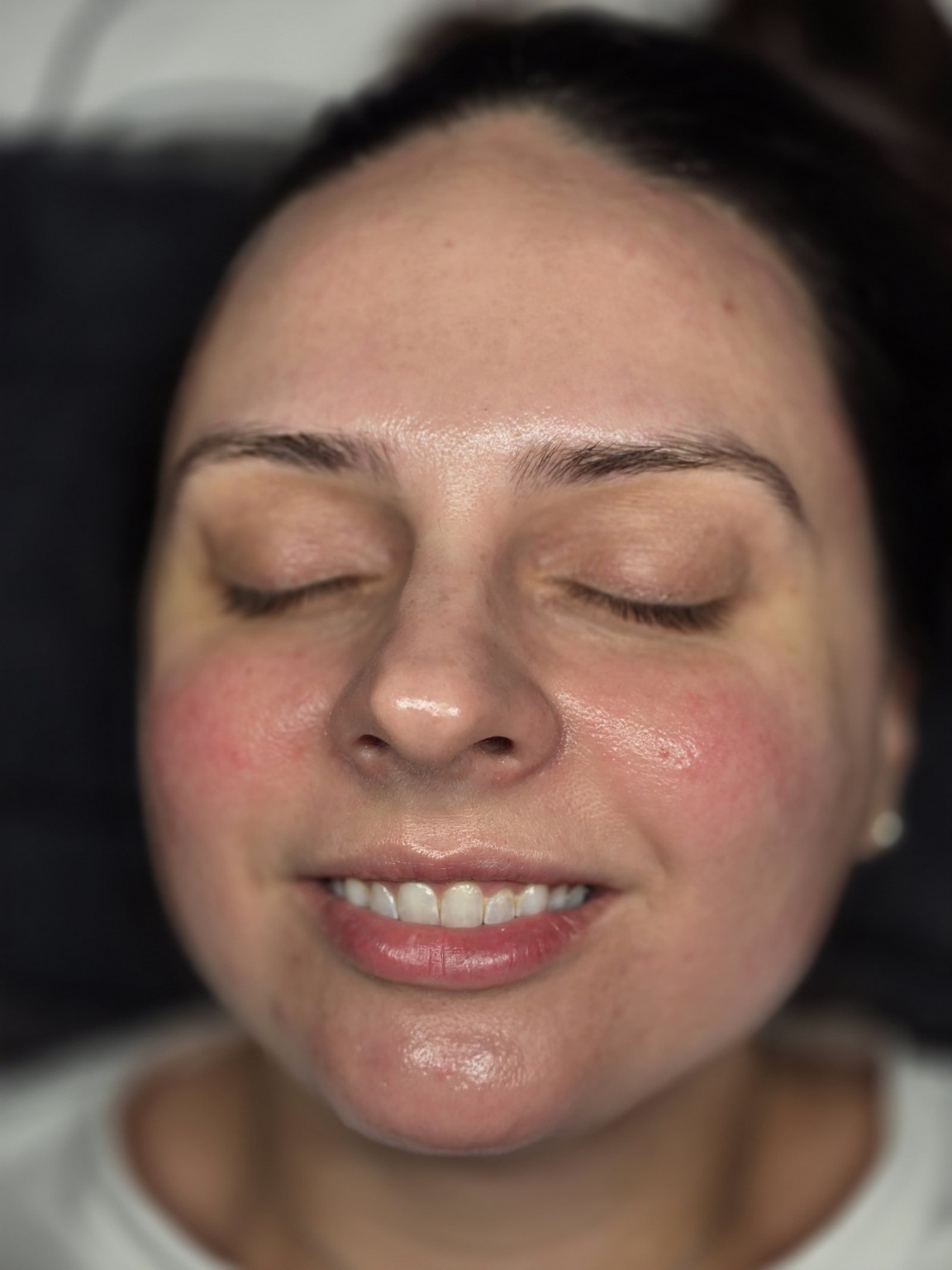 After facial treatment - Calming and Glow